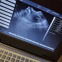 processed/086fd1f2-622f-4583-8937-8e33e06cd83d/facility/78576acd-19d7-4740-a5ed-267805bfd7d6