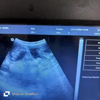 Bred *AKC/OFA+DNA/Titled, a female Dachshund for sale in Florence, KY – Photo 9 of 9